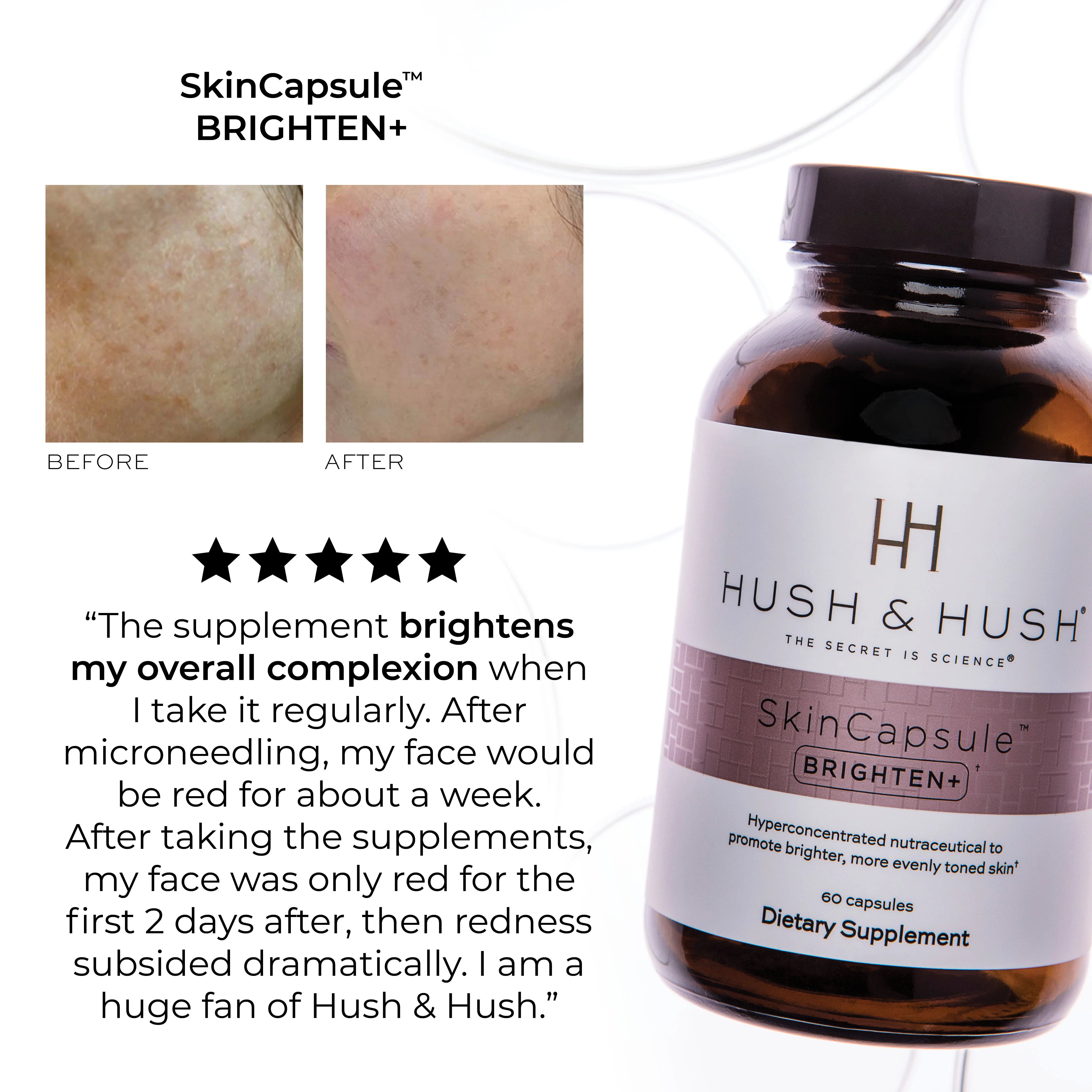Skin Saving Set: For Dull + Uneven Skin - Image 5